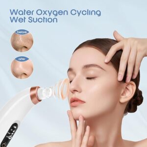 blackhead remover vacuum – usb rechargeable pore cleaner with 3 tips & multi level suction