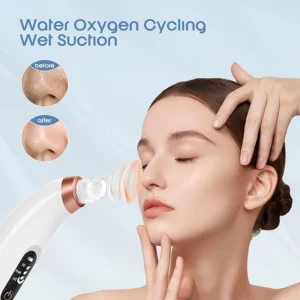 blackhead remover vacuum – usb rechargeable pore cleaner with 3 tips & multi level suction