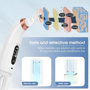 blackhead remover vacuum – usb rechargeable pore cleaner with 3 tips & multi level suction
