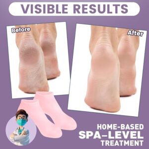 silicone moisturizing socks – reusable spa foot care for dry, cracked heels (pink, one size)