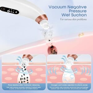 blackhead remover vacuum – usb rechargeable pore cleaner with 3 tips & multi level suction
