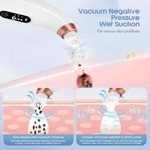 blackhead remover vacuum – usb rechargeable pore cleaner with 3 tips & multi level suction