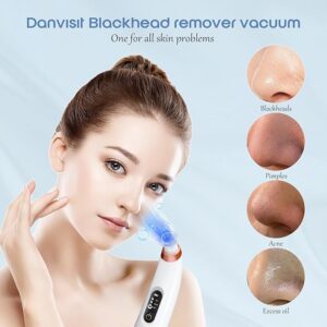 blackhead remover vacuum – usb rechargeable pore cleaner with 3 tips & multi level suction