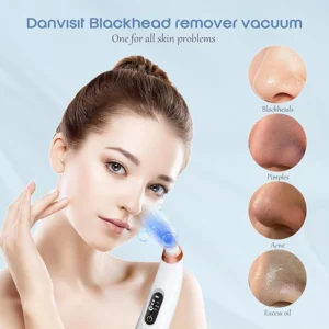 blackhead remover vacuum – usb rechargeable pore cleaner with 3 tips & multi level suction