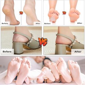 stainless steel foot file – double sided pedicure rasp & callus remover for cracked heels and dead skin (white)