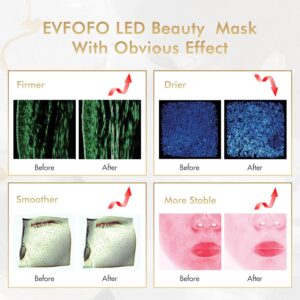 7 color led face mask – red & blue light therapy for skin rejuvenation, anti aging & acne care