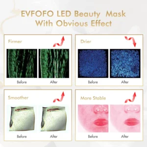 7 color led face mask – red & blue light therapy for skin rejuvenation, anti aging & acne care